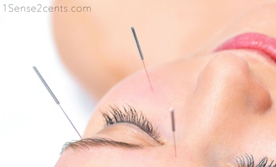 Basic Acupuncture Session | 1Sense2Cents